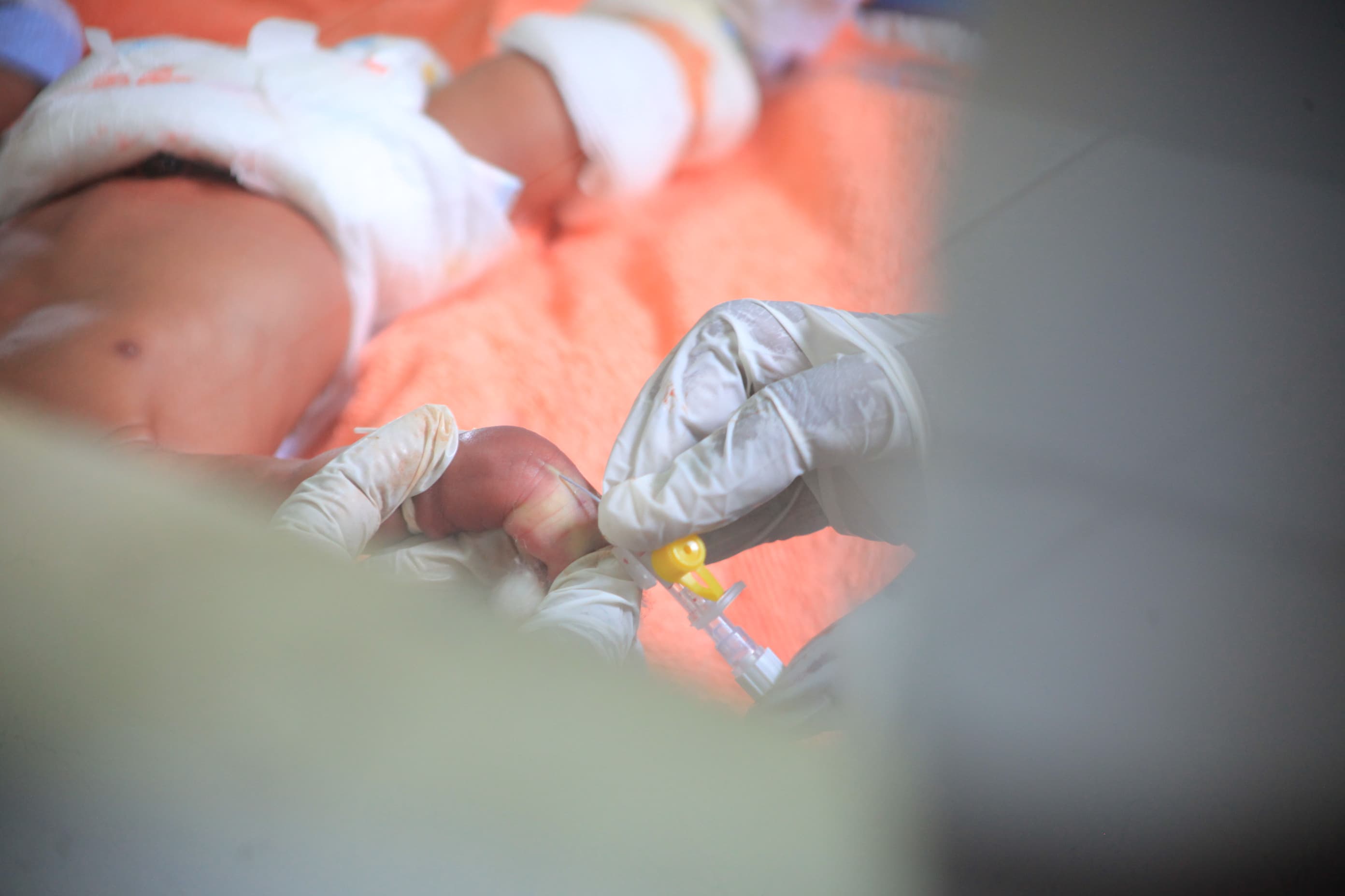 Illustrative: premature-baby care in an African hospital neonatal ward. IMPALA's continuous monitors are designed for exactly these low-resource paediatric settings, where staff are few and every minute of early warning counts.